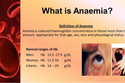 anemia