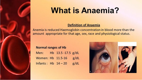 anemia